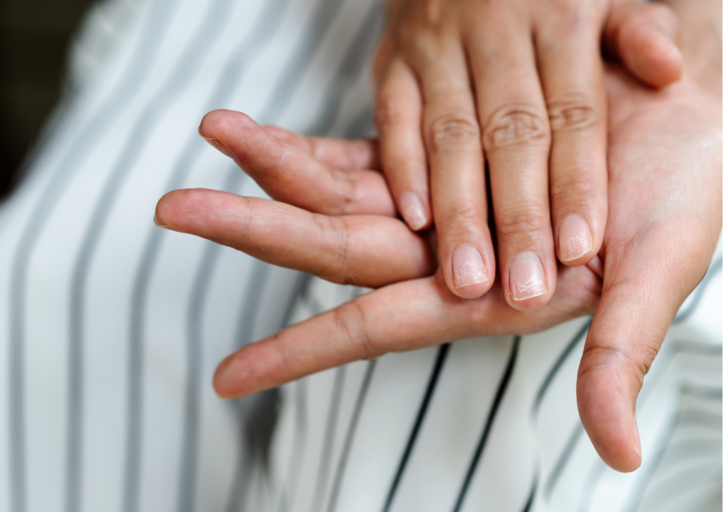 Brittle nails