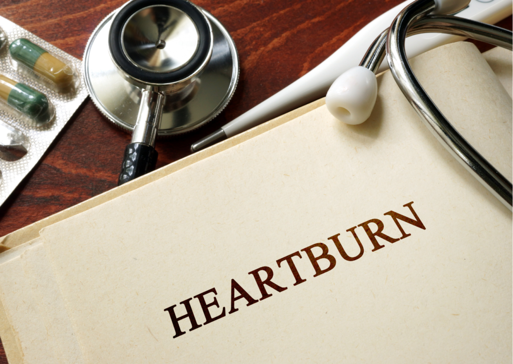 How to Prevent Heartburn Naturally